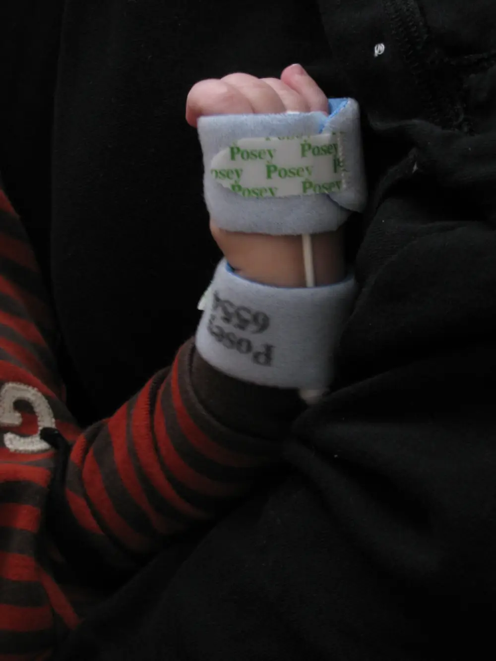 Read more about the article I Made James a Wrist Splint