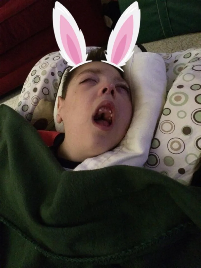 Read more about the article Easter, The Feeding Issues Continue, and Another Lost Tooth